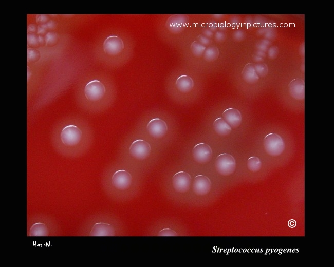 S.pyogenes colony morphology on blood agar beta-hemolysis around colonies of Streptococcus pyogenes, colony morphology